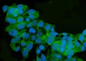 Immunofluorescent staining of FFPE human HepG2 cells with ARG2 antibody (green) and DAPI nuclear stain (blue). HIER: steam section in pH6 citrate buffer for 20 min.