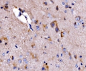 IHC staining of FFPE mouse brain tissue with ATG9A antibody. HIER: boil tissue sections in pH8 EDTA for 20 min and allow to cool before testing.