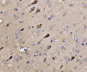 IHC staining of FFPE rat brain tissue with ATG9A antibody. HIER: boil tissue sections in pH8 EDTA for 20 min and allow to cool before testing.