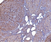 IHC staining of FFPE mouse ovary tissue with ERp5 antibody. HIER: boil tissue sections in pH8 EDTA for 20 min and allow to cool before testing.