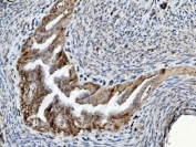 IHC staining of FFPE rat ovary tissue with ERp5 antibody. HIER: boil tissue sections in pH8 EDTA for 20 min and allow to cool before testing.