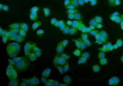 Immunofluorescent staining of FFPE human T-47D cells with Vesicle-fusing ATPase antibody (green) and DAPI nuclear stain (blue). HIER: steam section in pH6 citrate buffer for 20 min.