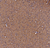 IHC staining of FFPE mouse brain tissue with Vesicle-fusing ATPase antibody. HIER: boil tissue sections in pH8 EDTA for 20 min and allow to cool before testing.