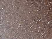 IHC staining of FFPE rat brain tissue with Vesicle-fusing ATPase antibody. HIER: boil tissue sections in pH8 EDTA for 20 min and allow to cool before testing.