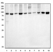 Western blot testing of human 1) placenta, 2) K562, 3) A549, 4) MCF7, 5) U-2 OS, 6) SW620, 7) 22RV1, 8) HepG2, 9) rat brain and 10) mouse brain lysate with Vesicle-fusing ATPase antibody. Predicted molecular weight ~82 kDa.