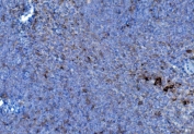 IHC staining of FFPE mouse spleen tissue with PDI antibody. HIER: boil tissue sections in pH8 EDTA for 20 min and allow to cool before testing.
