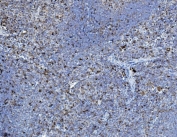 IHC staining of FFPE rat spleen tissue with PDI antibody. HIER: boil tissue sections in pH8 EDTA for 20 min and allow to cool before testing.