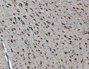 IHC staining of FFPE mouse brain tissue with INPPL1 antibody. HIER: boil tissue sections in pH8 EDTA for 20 min and allow to cool before testing.