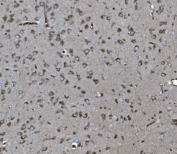 IHC staining of FFPE rat brain tissue with INPPL1 antibody. HIER: boil tissue sections in pH8 EDTA for 20 min and allow to cool before testing.