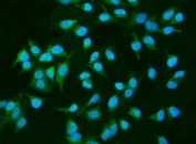 Immunofluorescent staining of FFPE human HeLa cells with INPPL1 antibody (green) and DAPI nuclear stain (blue). HIER: steam section in pH6 citrate buffer for 20 min.
