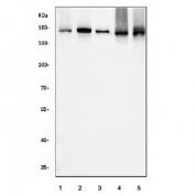 Western blot testing of 1) human HeLa, 2) human Raji, 3) human PC-3, 4) rat C6 and 5) mouse NIH-3T3 cell lysate with INPPL1 antibody. Predicted molecular weight ~139 kDa (isoform 1), ~113 kDa (isoform 2).