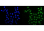 Immunofluorescent staining of FFPE human MCF7 cells with MCM6 antibody (green) and DAPI nuclear stain (blue). HIER: steam section in pH6 citrate buffer for 20 min.