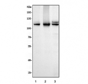 Western blot testing of human 1) HeLa, 2) Jurkat and 3) HEK293 cell lysate with MCM6 antibody. Expected molecular weight: 92-105 kDa.