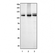 Western blot testing of human 1) HeLa, 2) Jurkat and 3) HEK293 cell lysate with MCM6 antibody. Expected molecular weight: 92-105 kDa.