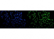 Immunofluorescent staining of FFPE human A549 cells with CBX5 antibody (green) and DAPI nuclear stain (blue). HIER: steam section in pH6 citrate buffer for 20 min.