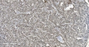 IHC staining of FFPE human adrenocortical adenoma tissue with CBX5 antibody. HIER: boil tissue sections in pH8 EDTA for 20 min and allow to cool before testing.