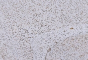 IHC staining of FFPE rat brain tissue with CBX5 antibody. HIER: boil tissue sections in pH8 EDTA for 20 min and allow to cool before testing.