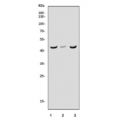 Western blot testing of 1) rat liver, 2) rat kidney and 3) mouse liver lysate with Aigp1 antibody. Predicted molecular weight ~53 kDa.