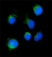 Immunofluorescent staining of FFPE mouse HEPA1-6 cells with Aigp1 antibody (green) and DAPI nuclear stain (blue). HIER: steam section in pH6 citrate buffer for 20 min.