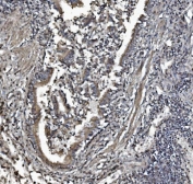 IHC staining of FFPE human lung tissue with Prohibitin 2 antibody. HIER: boil tissue sections in pH8 EDTA for 20 min and allow to cool before testing.