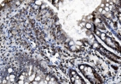 IHC staining of FFPE rat colon tissue with Prohibitin 2 antibody. HIER: boil tissue sections in pH8 EDTA for 20 min and allow to cool before testing.