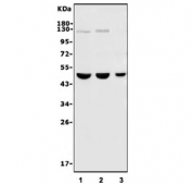 Western blot testing of human 1) HeLa, 2) A549 and 3) Raji cell lysate with CBX8 antibody. Predicted molecular weight ~43 kDa.