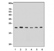 Western blot testing of 1) human HeLa, 2) human PC-3, 3) human U-2 OS, 4) rat liver, 5) mouse lung and 6) mouse liver lysate with ADP-ribosylation factor 6 antibody. Predicted molecular weight ~20 kDa.