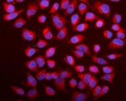 Immunofluorescent staining of FFPE human HeLa cells with Caspase-9 antibody (red) and DAPI nuclear stain (blue). HIER: steam section in pH6 citrate buffer for 20 min.