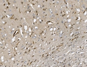 IHC staining of FFPE rat brain with Cd34 antibody. HIER: boil tissue sections in pH8 EDTA for 20 min and allow to cool before testing.