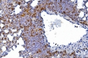 IHC staining of FFPE mouse lung tissue with Cd226 antibody. HIER: boil tissue sections in pH8 EDTA for 20 min and allow to cool before testing.