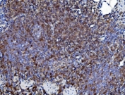 IHC staining of FFPE rat lung lymphoid tissue with Cd226 antibody. HIER: boil tissue sections in pH8 EDTA for 20 min and allow to cool before testing.