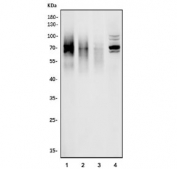 Western blot test of 1) rat spleen, 2) mouse spleen, 3) mouse thymus and 4) mouse RAW264.7 cell lysate with Cd226 antibody. Expected molecular weight: 35-70 kDa depending on glycosylation level.