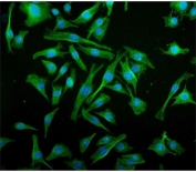 Immunofluorescent staining of FFPE mouse RM-1 cells with Interferon regulatory factor 3 antibody (green) and DAPI nuclear stain (blue). HIER: steam section in pH6 citrate buffer for 20 min.