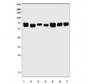 Western blot testing of human 1) placenta, 2) A549, 3) HeLa, 4) CCRF-CEM, 5) U-87 MG, 6) SH-SY5Y and 7) monkey heart lysate with EHD3 antibody. Predicted molecular weight ~61 kDa.