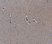 IHC staining of FFPE rat brain tissue with EHD3 antibody. HIER: boil tissue sections in pH8 EDTA for 20 min and allow to cool before testing.