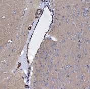 IHC staining of FFPE mouse brain tissue with EHD3 antibody. HIER: boil tissue sections in pH8 EDTA for 20 min and allow to cool before testing.