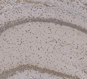 IHC staining of FFPE mouse brain tissue with EPRS antibody. HIER: boil tissue sections in pH8 EDTA for 20 min and allow to cool before testing.