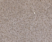 IHC staining of FFPE rat brain tissue with EPRS antibody. HIER: boil tissue sections in pH8 EDTA for 20 min and allow to cool before testing.