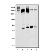 Western blot testing of 1) human Jurkat, 2) human HEK293, 3) human K562, 4) rat pancreas and 5) mouse pancreas tissue lysate with EPRS antibody. Predicted molecular weight ~171 kDa.