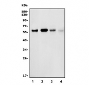 Western blot testing of human 1) HeLa, 2) Raji, 3) HepG2 and 4) mouse lung lysate with Interferon regulatory factor 3 antibody. Predicted molecular weight ~47 kDa.