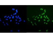 Immunofluorescent staining of FFPE human U-2 OS cells with Ku70/XRCC6 antibody (green) and DAPI nuclear stain (blue). HIER: steam section in pH6 citrate buffer for 20 min.