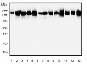Western blot testing of human 1) placenta, 2) A549, 3) HEK293, 4) HeLa, 5) K562, 6) U937, 7) HepG2 and rat 8) liver, 9) brain, 10) testis and mouse 11) liver, 12) brain and 13) testis tissue lysate with PFAS antibody. Predicted molecular weight ~145 kDa.