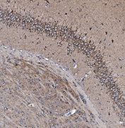 IHC staining of FFPE mouse brain tissue with PHB antibody. HIER: boil tissue sections in pH8 EDTA for 20 min and allow to cool before testing.