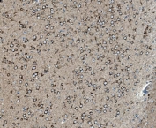 IHC staining of FFPE rat brain tissue with PHB antibody. HIER: boil tissue sections in pH8 EDTA for 20 min and allow to cool before testing.