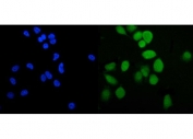 Immunofluorescent staining of FFPE human PC-3 cells with Phospholipid transfer protein antibody (green) and DAPI nuclear stain (blue). HIER: steam section in pH6 citrate buffer for 20 min.