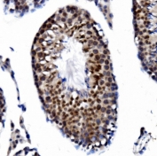 IHC staining of FFPE mouse testis tissue with PRDM14 antibody. HIER: boil tissue sections in pH8 EDTA for 20 min and allow to cool before testing.