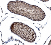 IHC staining of FFPE rat testis tissue with PRDM14 antibody. HIER: boil tissue sections in pH8 EDTA for 20 min and allow to cool before testing.