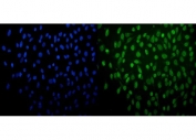 Immunofluorescent staining of FFPE human HeLa cells with PRDM14 antibody (green) and DAPI nuclear stain (blue). HIER: steam section in pH6 citrate buffer for 20 min.