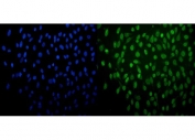 Immunofluorescent staining of FFPE human HeLa cells with PRDM14 antibody (green) and DAPI nuclear stain (blue). HIER: steam section in pH6 citrate buffer for 20 min.