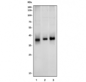 Western blot testing of human 1) U-87 MG, 2) ThP-1 and 3) A431 cell lysate with RTCA antibody. Predicted molecular weight ~39 kDa.